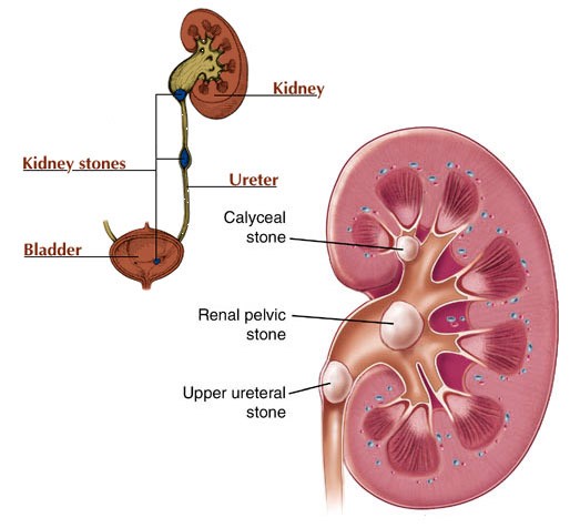 urologist in Nashik