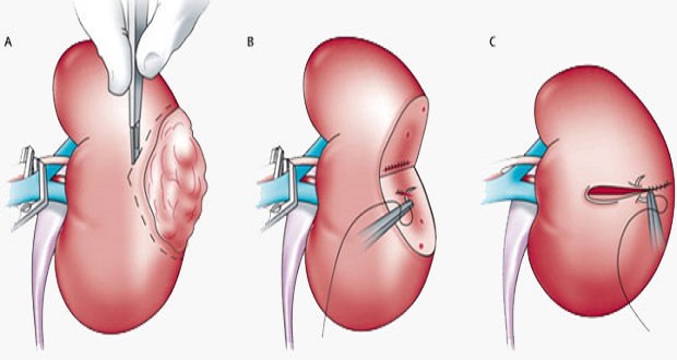 Best urologist in Nashik Urologist in Nashik