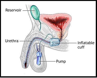 Best Urologist in Nashik