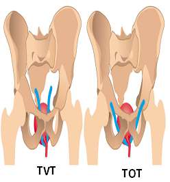 Best urologist in Nashik