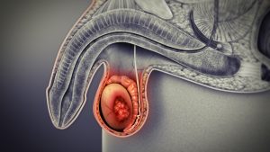 testicular