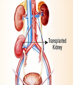 Best Urologist in Nashik